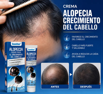 Compre 1 Llévate 2 – Crema Para Crecimiento Capilar ProHair™